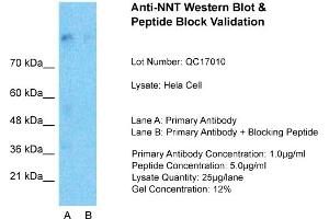 Host:  Rabbit  Target Name:  NNT  Sample Type:  Hela Whole cell  Lane A:  Primary Antibody  Lane B:  Primary Antibody + Blocking Peptide  Primary Antibody Concentration:  1ug/ml  Peptide Concentration:  5ug/ml  Lysate Quantity:  25ug/lane/Lane  Gel Concentration:  0. (NNT 抗体  (N-Term))