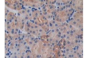Immunohistochemistry (IHC) image for anti-Interleukin 17 Receptor A (IL17RA) (AA 590-848) antibody (ABIN7438775)