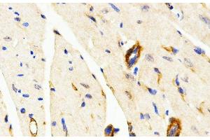 Immunohistochemistry of paraffin-embedded Mouse heart using LAMP3 Polyclonal Antibody at dilution of 1:200 (40x lens). (LAMP3 抗体)