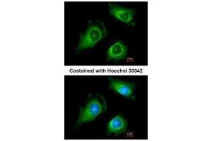 ICC/IF Image Immunofluorescence analysis of methanol-fixed HeLa, using Fukutin, antibody at 1:200 dilution. (Fukutin 抗体)