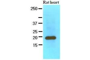 The extracts of Rat heart (60 ug) were resolved by SDS-PAGE, transferred to nitrocellulose membrane and probed with anti-human MYL2 (1:1000). (MYL2 抗体  (AA 1-166))