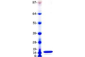 Western Blotting (WB) image for Serum Amyloid A1 (SAA1) (Transcript Variant 1) protein (Myc-DYKDDDDK Tag) (ABIN2731846)