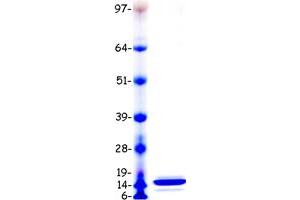 Validation with Western Blot (SAA1 Protein (Transcript Variant 1) (Myc-DYKDDDDK Tag))
