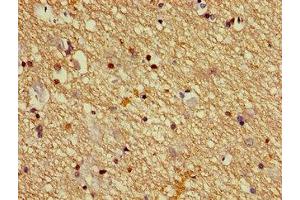 Immunohistochemistry (IHC) image for anti-Dihydropyrimidinase-Like 2 (DPYSL2) (AA 1-572) antibody (ABIN7149930)