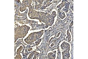 IHC analysis of Aldolase/ALDOA using anti-Aldolase/ALDOA antibody (ABIN7601908). (ALDOA 抗体  (AA 50-364))