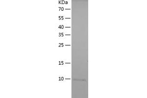 Western Blotting (WB) image for Protein Kinase C, eta (PRKCH) (AA 614-674) protein (His tag) (ABIN7124654) (PKC eta Protein (AA 614-674) (His tag))