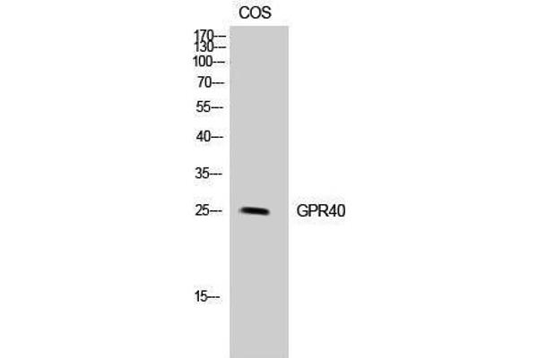 FFAR1 抗体  (Internal Region)