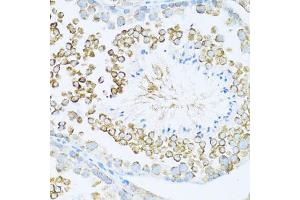 Immunohistochemistry of paraffin-embedded mouse testis using DVL1 antibody (ABIN7266796) at dilution of 1:100 (40x lens). (DVL1 抗体  (AA 510-640))