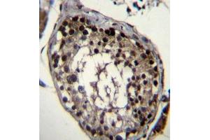 Formalin fixed, paraffin embedded human testis tissue stained with DAZ4 Antibody  followed by peroxidase conjugation of the secondary antibody and DAB staining. (DAZ4 抗体  (Middle Region))