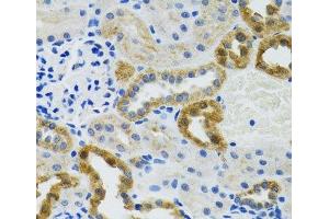 Immunohistochemistry of paraffin-embedded Mouse kidney using POLG2 Polyclonal Antibody at dilution of 1:100 (40x lens).