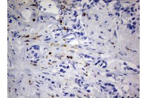 Image no. 4 for anti-Paternally Expressed 3 (PEG3) (AA 1-364) antibody (ABIN1490765)