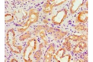 Immunohistochemistry of paraffin-embedded human kidney tissue using ABIN7143106 at dilution of 1:100 (ACTR3B 抗体  (AA 189-418))