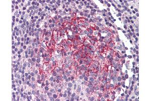 Anti-IL1R2 antibody IHC of human small intestine, Peyer's patch. (IL1R2 抗体)
