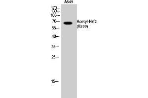 Western Blot analysis of A549 cells using Acetyl-Nrf2 (K599) Polyclonal Antibody.