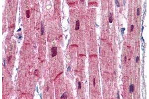 Human Heart: Formalin-Fixed, Paraffin-Embedded (FFPE) (ACTN2 抗体  (AA 215-500))