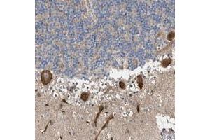 Immunohistochemical staining of human cerebellum with MFSD6 polyclonal antibody  shows strong cytoplasmic positivity in Purkinje cells. (MFSD6 抗体)