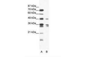 Image no. 1 for anti-Zinc Finger Protein 577 (ZNF577) (AA 373-422) antibody (ABIN202626) (ZNF577 抗体  (AA 373-422))