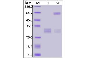 SDS-PAGE (SDS) image for CD8 (CD8) (AA 22-182) (Active) protein (His tag,FITC) (ABIN6973025)