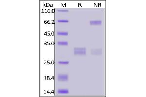 Fed Human CD8A&CD8B Heterodimer Protein, His Tag&Tag Free on  under reducing (R) and ing (NR) conditions. (CD8 Protein (CD8) (AA 22-182) (His tag,FITC))
