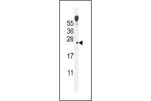ECOP Antibody (Center) (ABIN655147 and ABIN2844768) western blot analysis in mouse lung tissue lysates (35 μg/lane). (VOPP1 抗体  (AA 65-95))