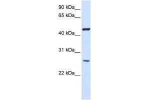 TMEM127 antibody used at 1 ug/ml to detect target protein. (TMEM127 抗体  (Middle Region))
