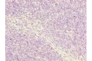 Immunohistochemistry of paraffin-embedded human thymus tissue using ABIN7162915 at dilution of 1:100 (Periostin 抗体  (AA 24-836))
