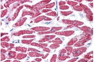 Human Heart: Formalin-Fixed, Paraffin-Embedded (FFPE) (GPX4 抗体  (AA 72-121))