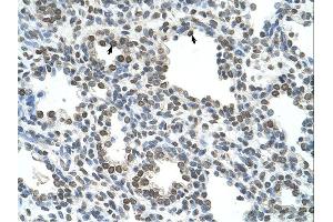 NKD1 antibody was used for immunohistochemistry at a concentration of 4-8 ug/ml. (NKD1 抗体)
