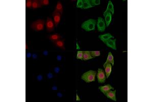 ABIN7093236 and ABIN7097248 staining Hela cells(heat shock treatment) by IF/ICC. (FOXO3 抗体  (acLys271))