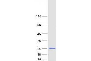 Western Blotting (WB) image for ADP-Ribosylation Factor 1 (ARF1) (Transcript Variant 3) protein (Myc-DYKDDDDK Tag) (ABIN2714426)