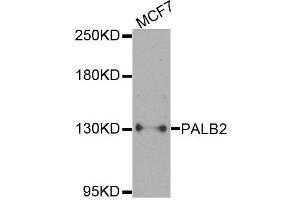 Western blot analysis of extracts of MCF7 cells, using PALB2 antibody. (PALB2 抗体)