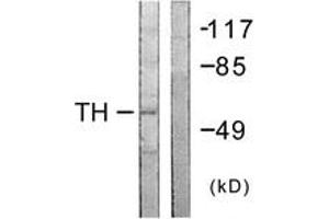 Western Blotting (WB) image for anti-Tyrosine Hydroxylase (TH) (AA 5-54) antibody (ABIN2888712) (Tyrosine Hydroxylase 抗体  (AA 5-54))