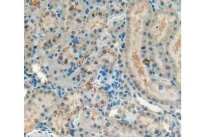 IHC-P analysis of kidney tissue, with DAB staining. (NG2 抗体  (AA 1919-2258))