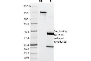 SDS-PAGE Analysis Purified MITF Mouse Monoclonal Antibody (SPM290). (MITF 抗体)