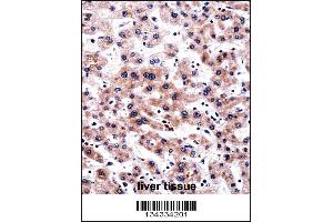 RCAN3 Antibody immunohistochemistry analysis in formalin fixed and paraffin embedded human liver tissue followed by peroxidase conjugation of the secondary antibody and DAB staining. (RCAN3 抗体  (C-Term))