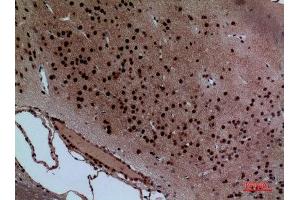 Immunohistochemistry (IHC) image for anti-Layilin (LAYN) (Internal Region) antibody (ABIN3187757)