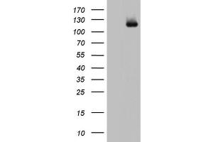 Western Blotting (WB) image for anti-ADAM Metallopeptidase with Thrombospondin Type 1 Motif, 1 (ADAMTS1) (AA 412-644) antibody (ABIN2715714) (ADAMTS1 抗体  (AA 412-644))