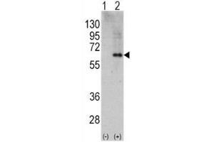Western Blotting (WB) image for anti-Protein Kinase, AMP-Activated, alpha 2 Catalytic Subunit (PRKAA2) (AA 453-483) antibody (ABIN3032385)