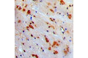 Immunohistochemical analysis of VCP staining in human brain formalin fixed paraffin embedded tissue section.
