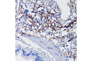 Immunohistochemistry (IHC) image for anti-Clusterin (CLU) (AA 23-120) antibody (ABIN6138756)