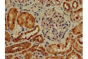 Immunohistochemistry of paraffin-embedded human kidney tissue using ABIN7163291 at dilution of 1:100 (PIK3R4 抗体  (Regulatory Subunit 4))