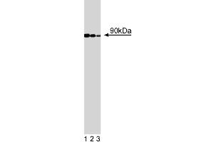 Western blot analysis of GGA3 on a Jurkat cell lysate (Human T-cell leukemia, ATCC TIB-152). (GGA3 抗体  (AA 424-542))