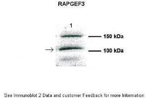 Human CFBE (RAPGEF3 抗体  (Middle Region))