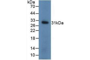Detection of Recombinant UCHL1, Mouse using Polyclonal Antibody to Ubiquitin Carboxyl Terminal Hydrolase L1 (UCHL1) (UCHL1 抗体  (AA 2-223))