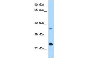 WB Suggested Anti-Rab13 Antibody Titration: 1. (RAB13 抗体  (Middle Region))