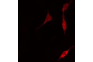 ABIN6266510 staining A549 cells by IF/ICC. (Claudin 5 抗体  (C-Term))