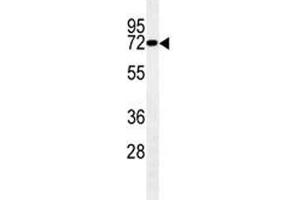 LIMK1 antibody western blot analysis in mouse brain tissue lysate. (LIM Domain Kinase 1 抗体  (AA 479-508))