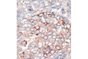 Image no. 2 for anti-Phosphoinositide 3-kinase Regulatory Subunit 4 (PIK3R4) (N-Term) antibody (ABIN360462) (PIK3R4 抗体  (N-Term))