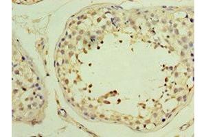 Immunohistochemistry of paraffin-embedded human testis tissue using ABIN7174000 at dilution of 1:100 (YARS2 抗体  (AA 228-477))