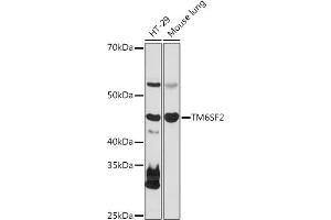 Western blot analysis of extracts of various cell lines, using TM6SF2 antibody (ABIN7270937) at 1:1000 dilution. (TM6SF2 抗体)